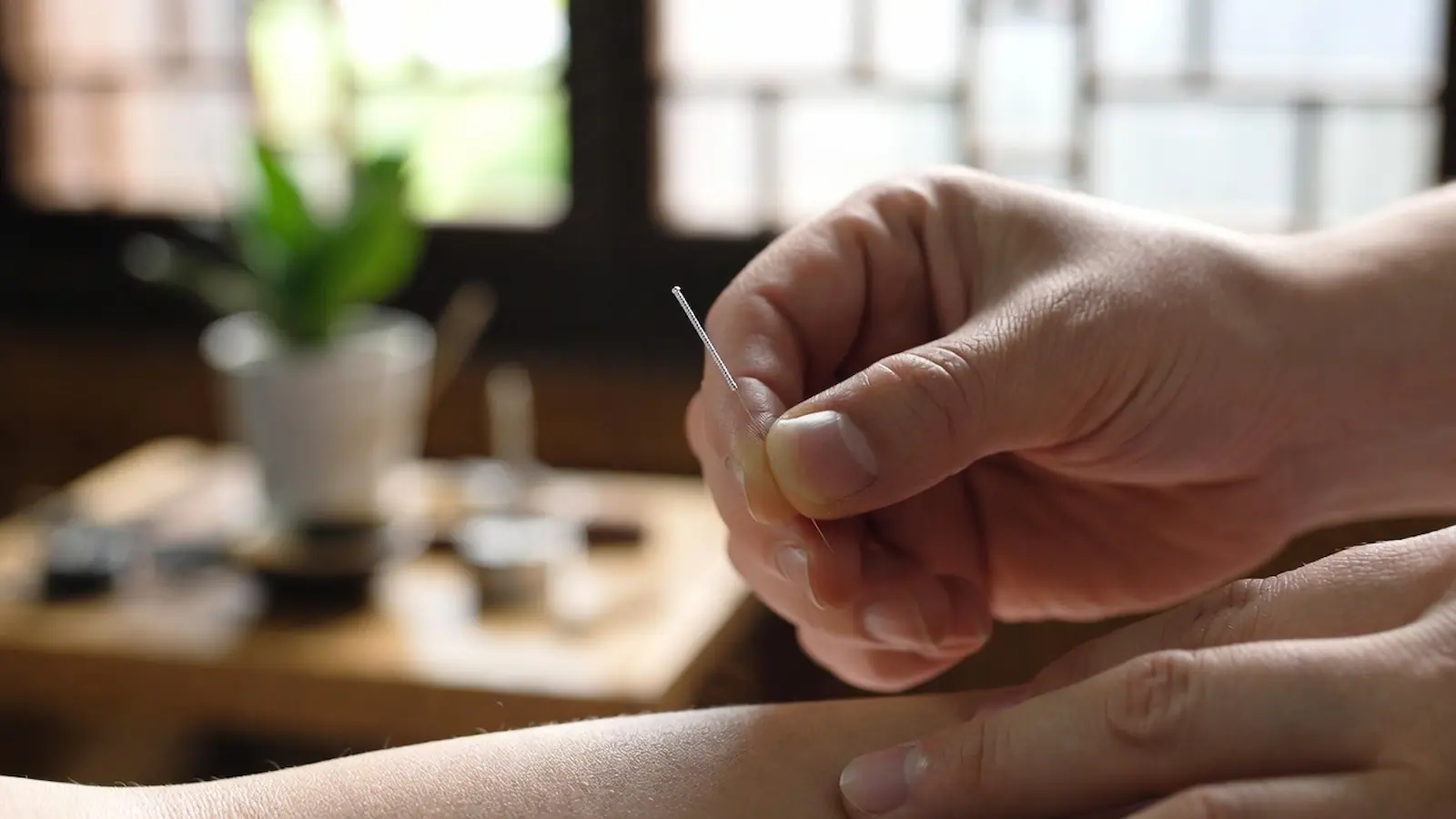 Akupunkturnadel wird präzise in den Arm eines Patienten gesetzt